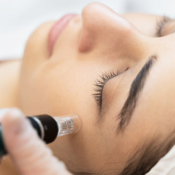 Micro Needling Therapy System (MTS or Vampire facial)