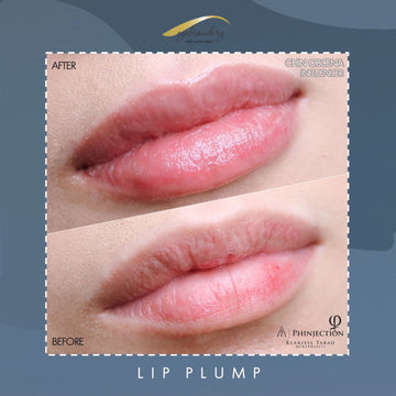 Lip Plump