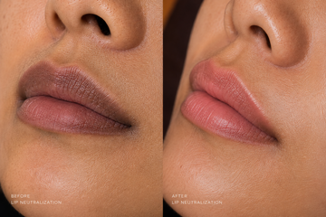 Dark Lip Neutralization